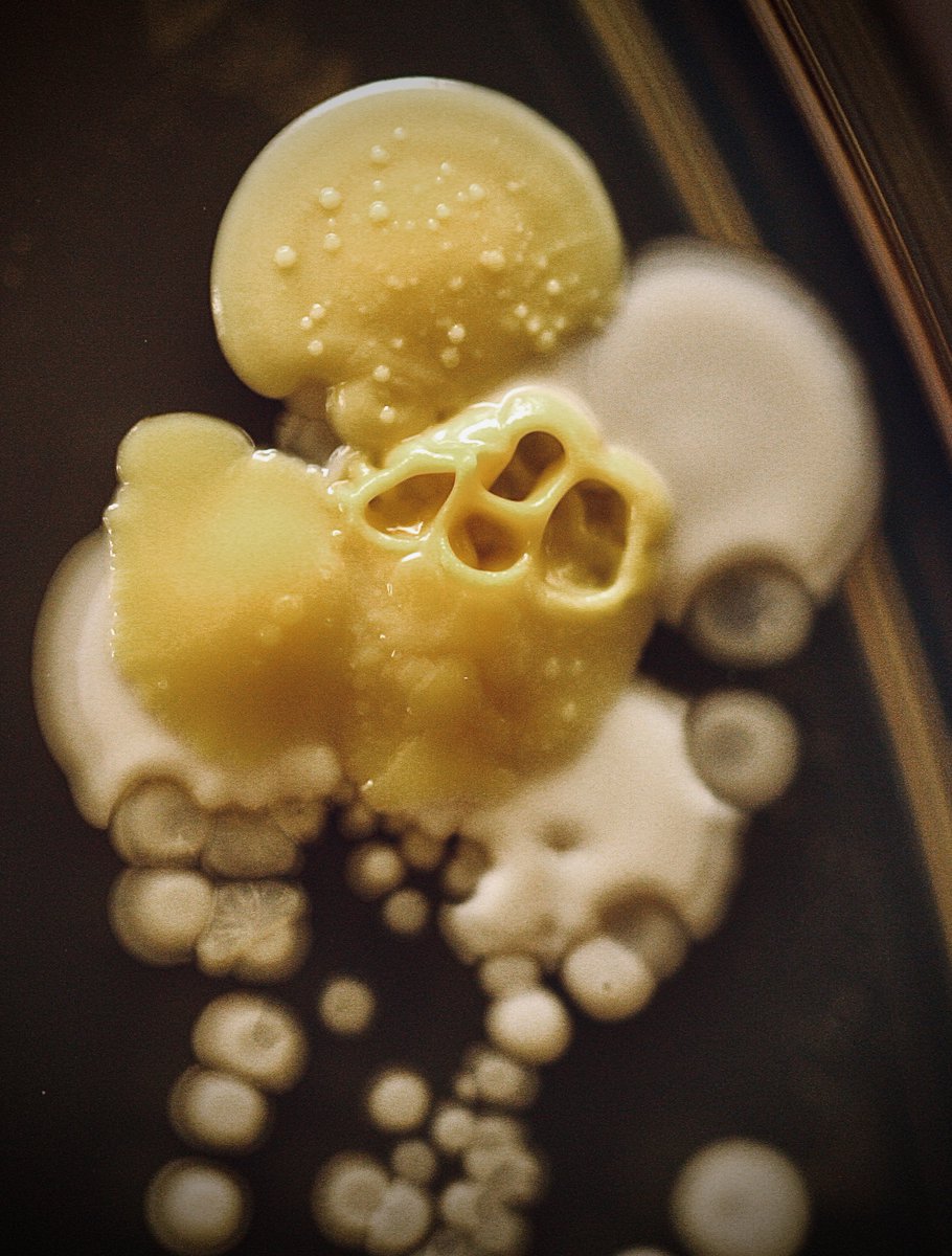 tasturm1's tweet image. #DescribeThatMicrobe I love how rich and varied the colors and textures are a month after these microbial #Handprints were done. @ASMicrobiology @HardyDiagnostic #Microbiology #Science #scicomm