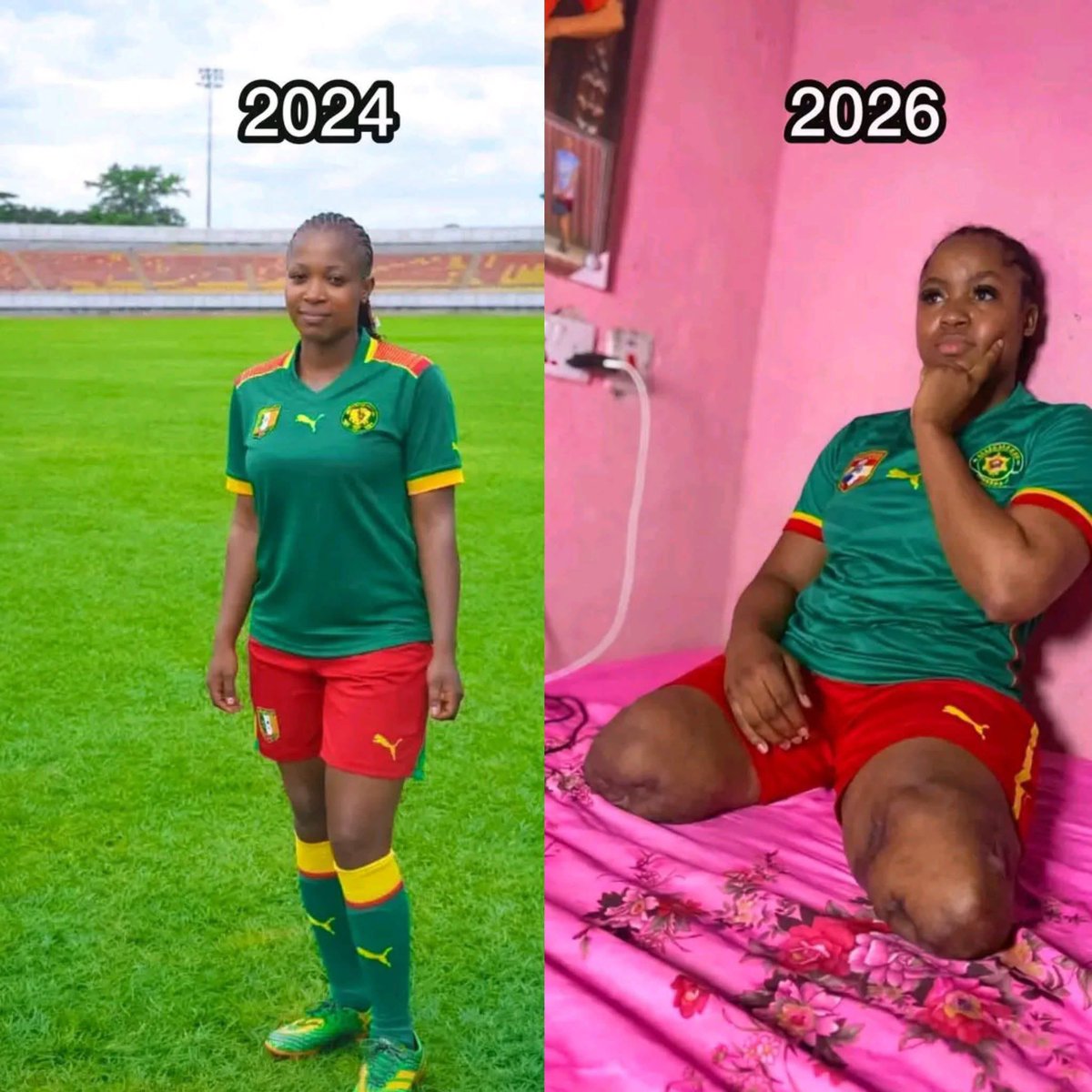 Triste destinée pour cette jeune femme 💔😭:
AVANT : elle était une footballeuse professionnelle et vivait de sa passion ⚽️
MAINTENANT : après un accident, qui lui a fait perdre l'usage de ses deux jambes, elle vit désormais à la maison, avec beaucoup de tristesse et d'espoir 😢