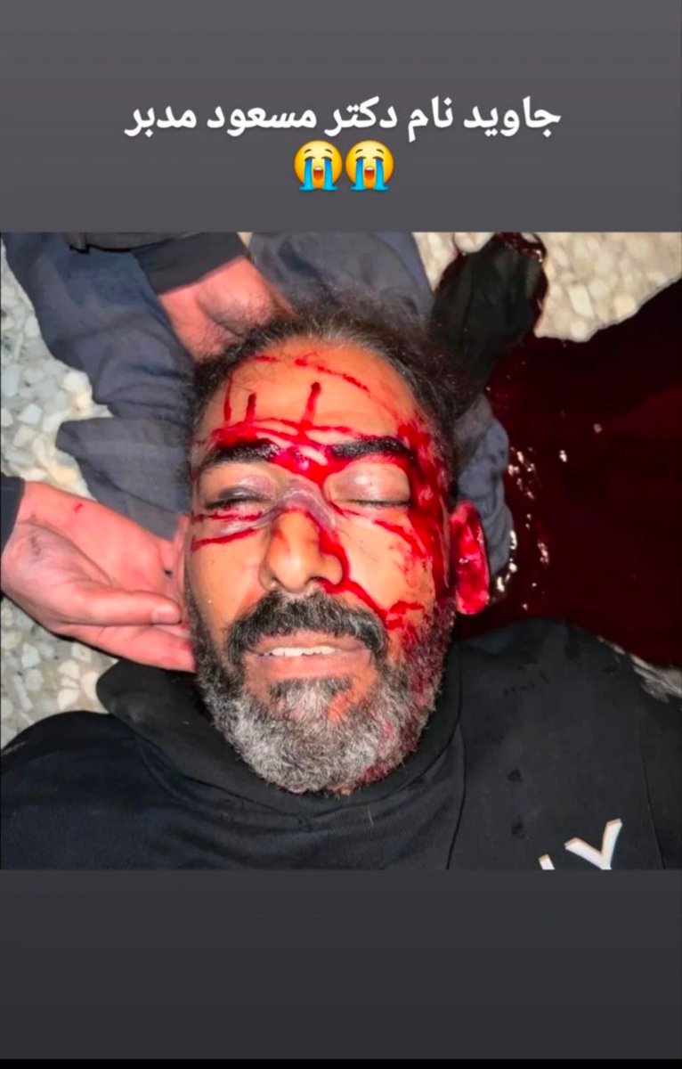 jacob15759299's tweet photo. 🔴 جاوید نام دکتر مسعود مدبر
حروم زاده ها تمام شلیک هاشون به سر و به نیت مرگ حتمی است
لعنت به دین و آیین تون https://t.co/QgYfeEfOJU