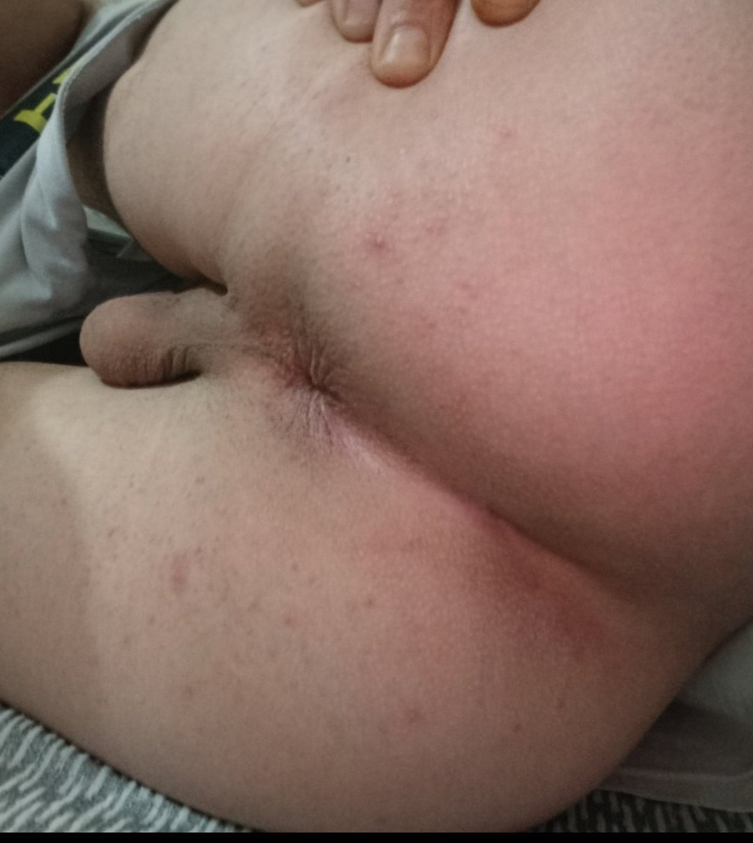 Rize genc aktifler   Rize merkez de yaşıyorum 
Arada bir görüşeceğim genç aktifler 
Özelden DM lütfen boş yapacaklar yazmasın 🙏🙏🙏🙏