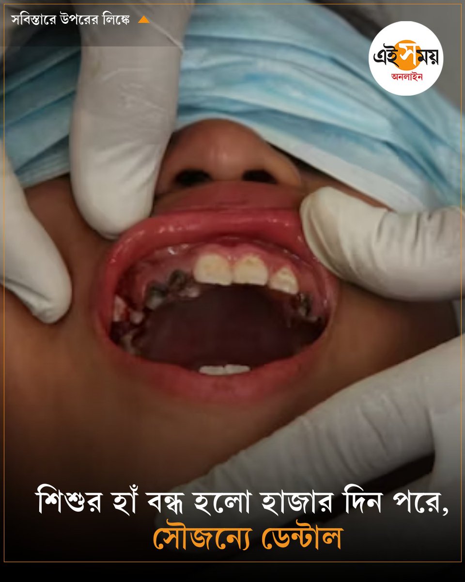 Ei_Samay's tweet image. আড়াই বছর ধরে মুখ বন্ধ করতে পারেনি বালিকা, অসাধ্যসাধন করল এই ডেন্টাল কলেজ
➡️ eisamay.com/lifestyle/heal…
#dentalcollege #HealthNews #healthbenefits #eisamayonline #EiSamay