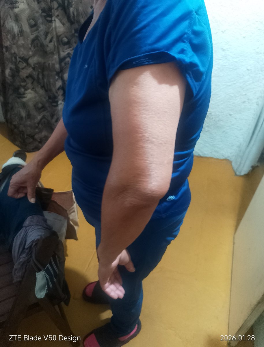 JuanGaray123's tweet photo. Otra vez el loco, la espero a mi mamá cuando salía a hacer los mandados y ésta vez la agredió físicamente le daba tremendas piñas y la corrió media cuadra hasta que ella se pudo refugiar en la casa de una vecina y desde ahí mí mamá llamo al 911 la vecina llamo y ahora mí mamá la https://t.co/6WV8r8Atbk