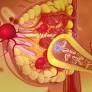 Chemistryaward's tweet image. Soluble E-cadherin drives brain metastasis in aggressive inflammatory breast cancer
More Information: research-chemistry.blogspot.com
#sciencefather #researchchemistry #biochemistry #scientist #professor #phd #awards #tags #science