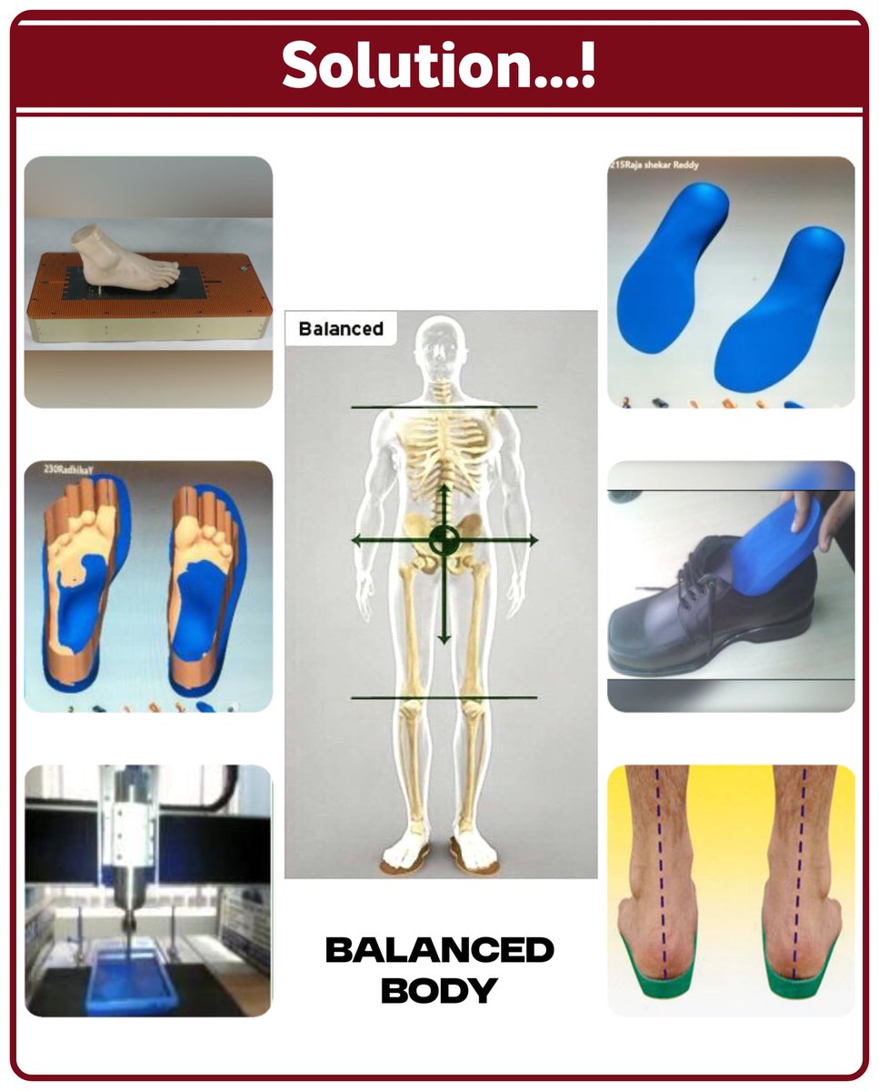 FDMTC_'s tweet photo. 🦶Common Foot Problems You Shouldn’t Ignore |🦶నిర్లక్ష్యం చేయకూడని సాధారణ పాద సమస్యలు | The Right Solution for a Balanced &amp; Pain-Free Body | సమతుల్యమైన &amp; నొప్పిలేని శరీరానికి సరైన పరిష్కారం 
#footcare #footdoctor https://t.co/lWC3Gg5kPj