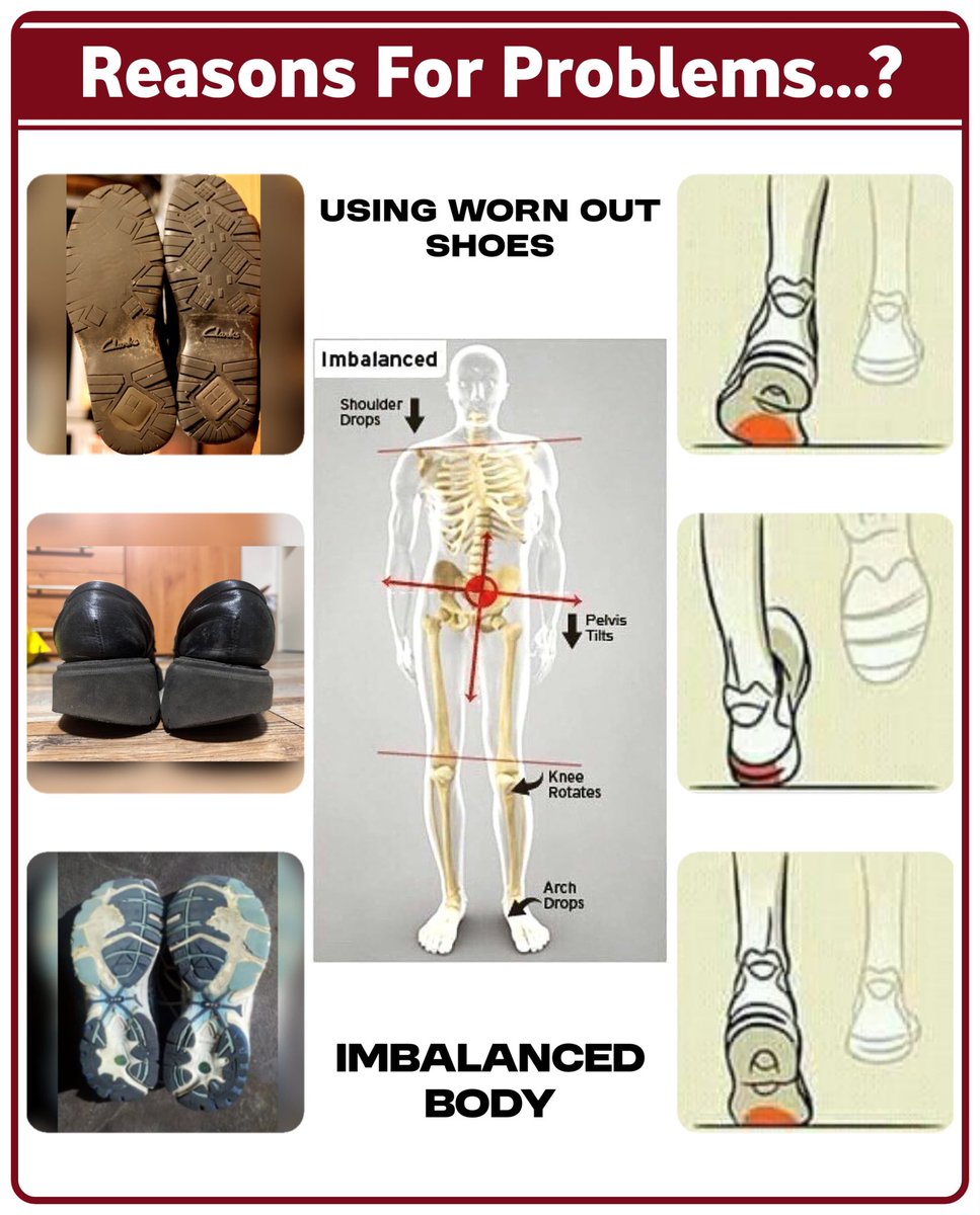 FDMTC_'s tweet photo. 🦶Common Foot Problems You Shouldn’t Ignore |🦶నిర్లక్ష్యం చేయకూడని సాధారణ పాద సమస్యలు | The Right Solution for a Balanced &amp; Pain-Free Body | సమతుల్యమైన &amp; నొప్పిలేని శరీరానికి సరైన పరిష్కారం 
#footcare #footdoctor https://t.co/lWC3Gg5kPj