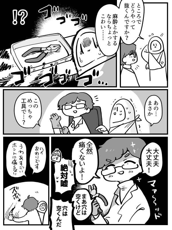 昔 自転車で事故って骨折して手術した話
穴の痕は今もあります 