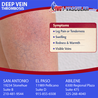 ivascularSA's tweet photo. Each year, about 350,000 Americans are diagnosed with Deep Vein Thrombosis (DVT), where blood clots form in the deep veins of your body resulting in pulmonary embolism and possibly death. If you experience any of the symptoms, contact I-Vascular Center: https://t.co/CLLaOdyQN8 https://t.co/qnRq3UOs32