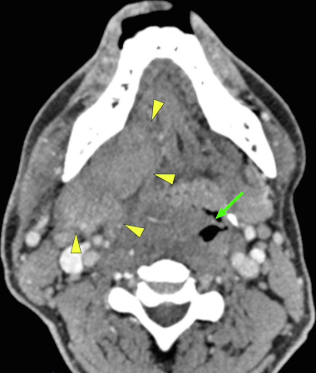 JACEP Open tweet media