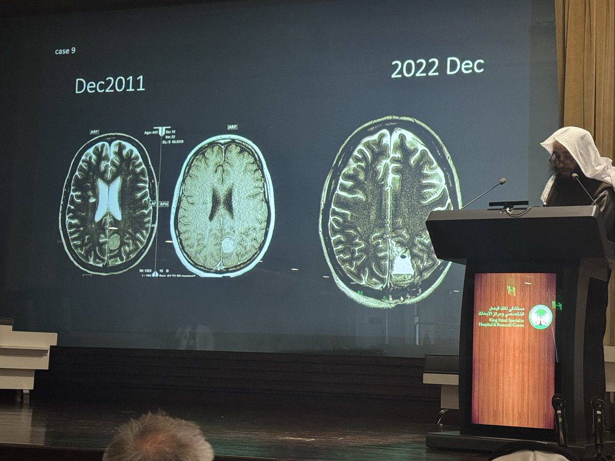 Continuing Session 1: Advanced Imaging in Neuro-Oncology

🧠 Distinguishing Pseudoprogression from True Progression
🕝 2:20–2:40 PM
Dr. Fahad Albadr

A practical, case-based approach to differentiating treatment-related changes from true tumor progression, highlighting the role