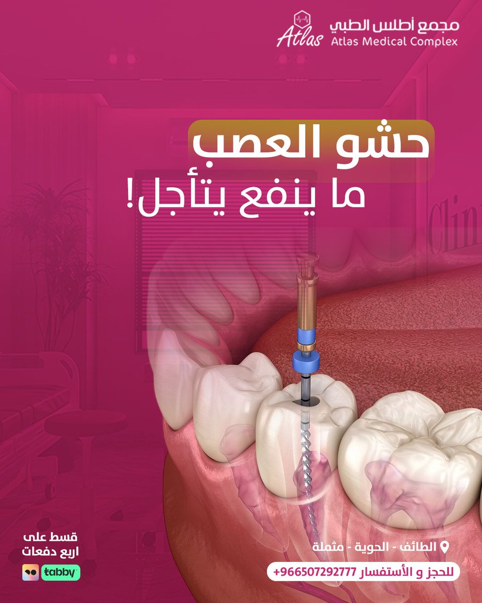 عند التهاب العصب أو التسوس العميق، الألم يزيد وحساسية الحرارة والبرودة تتفاقم. تأخير الحشو قد يسبب فقدان السن وانتشار العدوى ورفع تكلفة العلاج.
💡 الحل: حشو العصب في الوقت المناسب يوقف الألم ويحمي أسنانك.
⏳ لا تنتظر.

#ابتسامتك_سعيدة #عيادة_اسنان #دكتور_اسنان #حشو_عصب