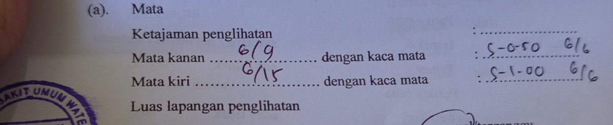 shipadd's tweet image. tiba-tiba banget mata minus 1 sama 0,5. Ga ada gejala samsek, kalo liat jg ga burem jugaa, trnyata oohh ternyataaa... salah sendiri belum pernah periksa mata :(