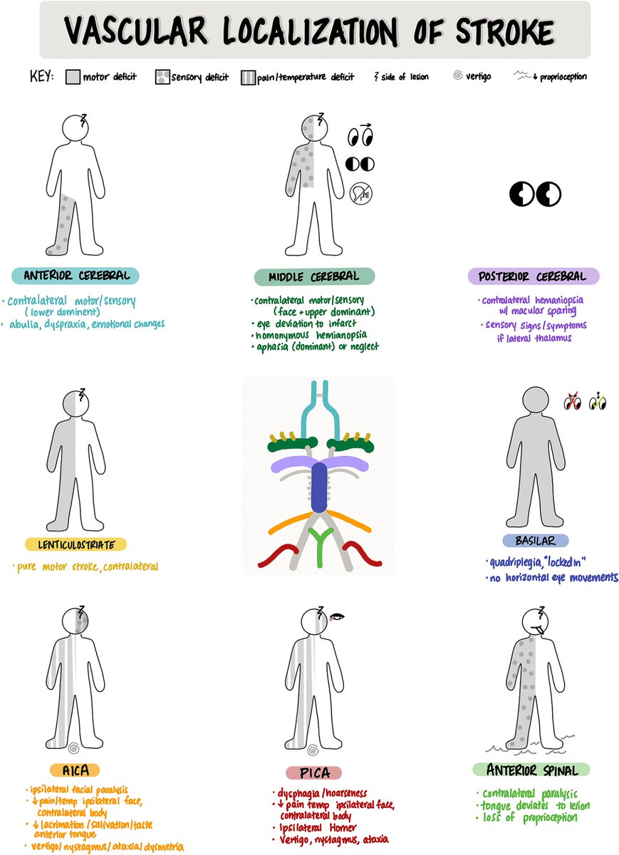 Vascular Localisation of Stroke