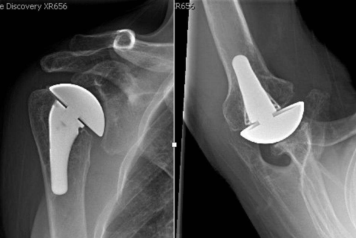 Rick Matsen tweet media