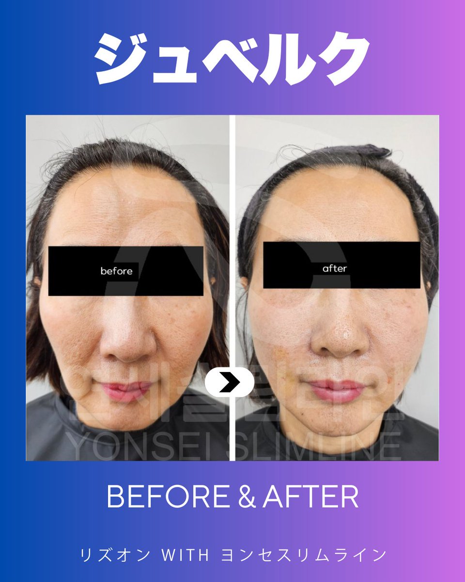 ヨンセスリムライン医院 tweet media