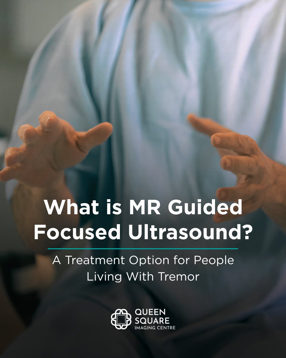 MR Guided Focused Ultrasound is an incisionless treatment that targets the area of the brain responsible for tremor, using real-time MRI guidance.

No implants. No hospital stay.

🌐 vist.ly/4pkrz

#FocusedUltrasound #EssentialTremor #Parkinsons