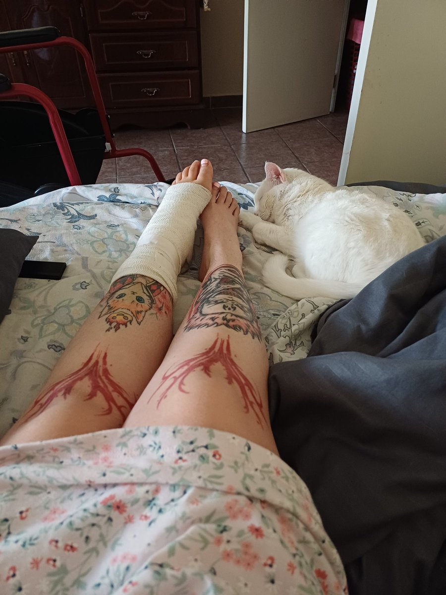 asteringirl's tweet image. Cuidando a la lisiada 😂🤍🖤