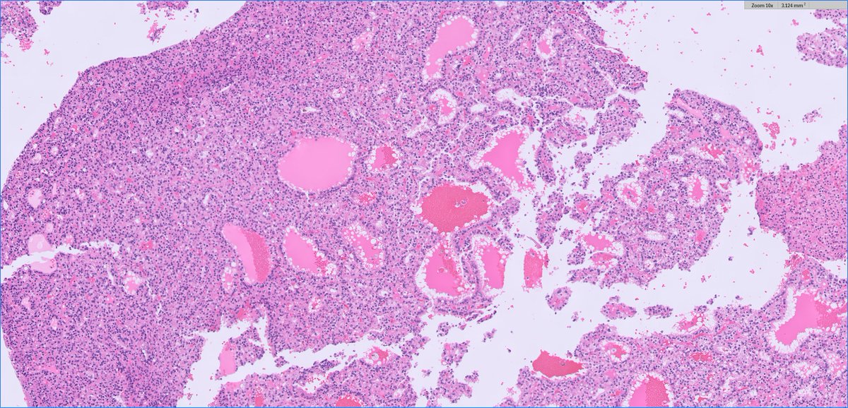 Ankur Sangoi tweet media