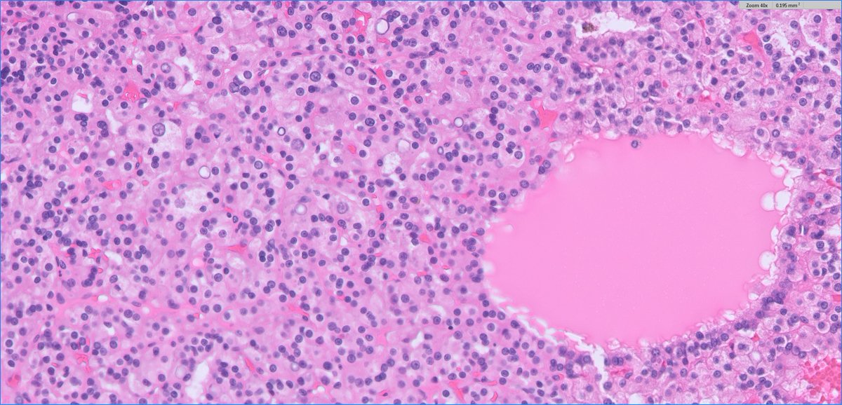 Ankur Sangoi tweet media