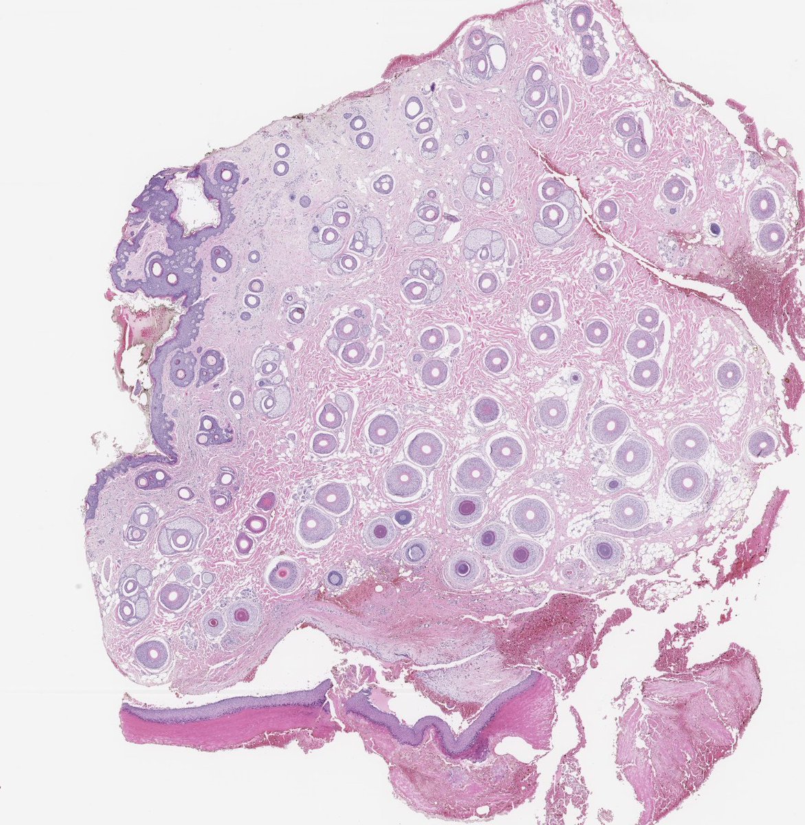 Toby Schmitt, MD tweet media