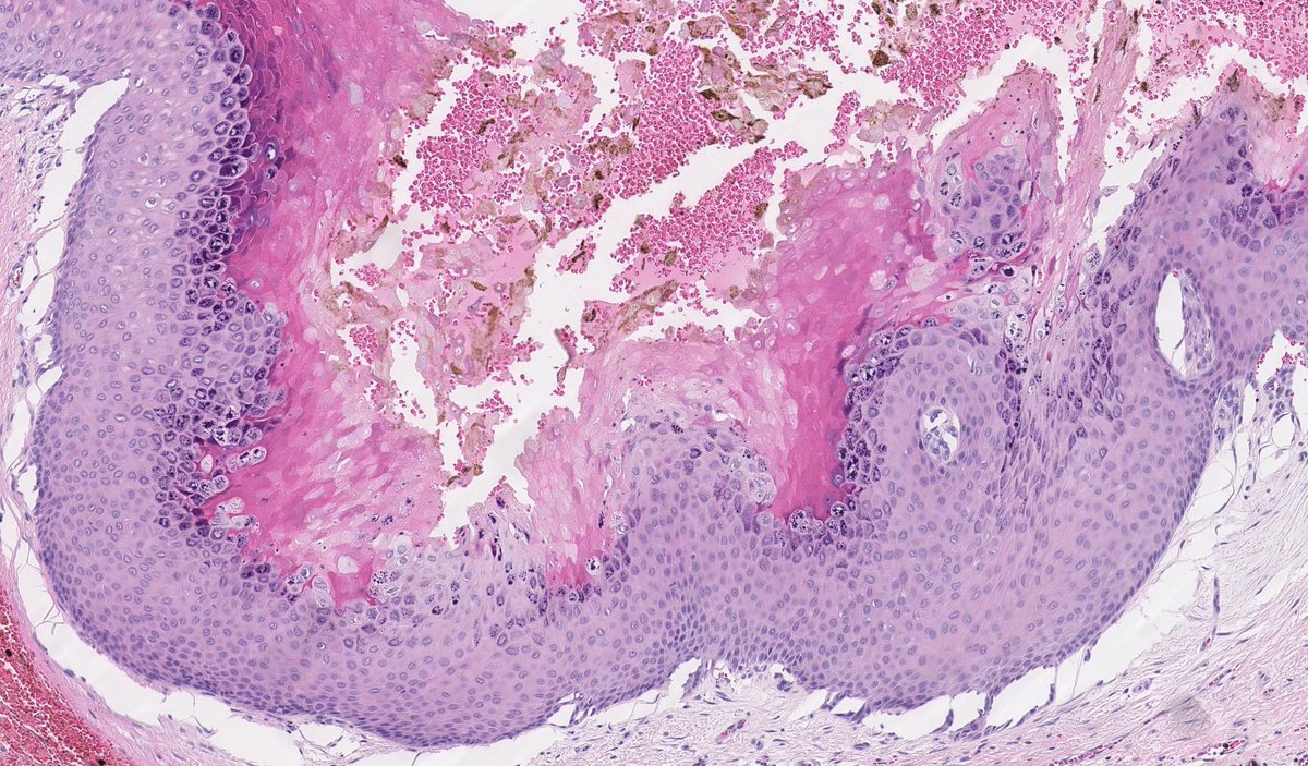 Toby Schmitt, MD tweet media