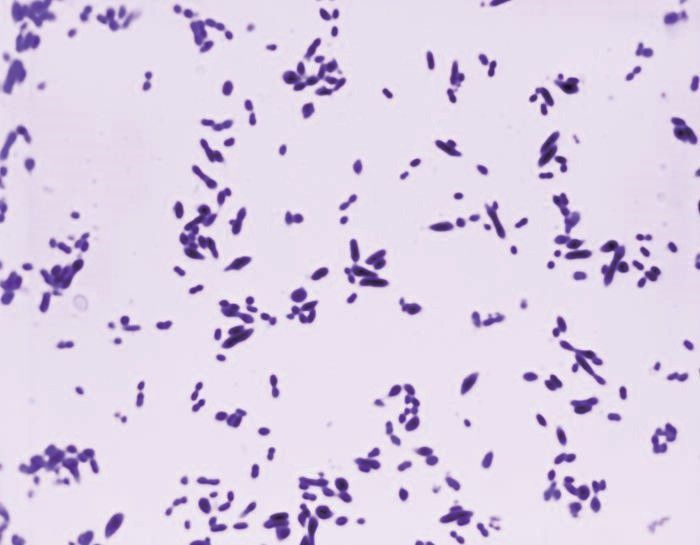 Advance your S. pneumoniae research with precision. From antigens to high-affinity antibodies, we provide the tools needed for breakthrough vaccine and diagnostic development. Explore our full catalog here: buff.ly/YDmW7LI
<a href="/winsletkerry/">Creative Diagnostics</a>