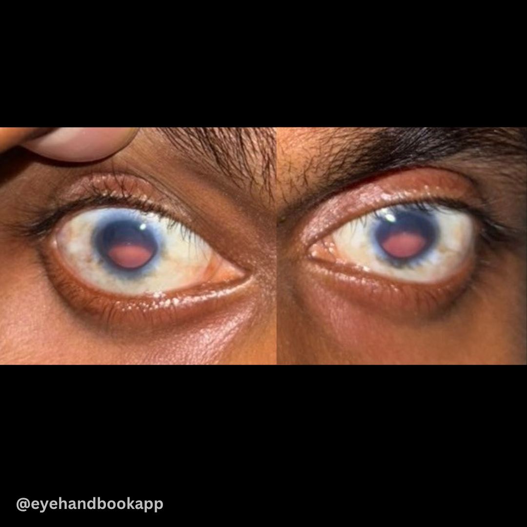 Eye Handbook tweet media