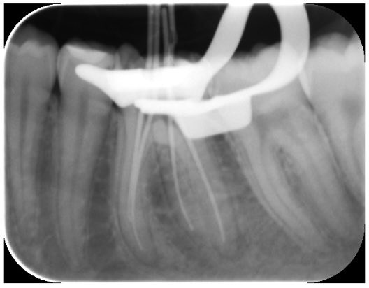 أنـوار الحربي . tweet media