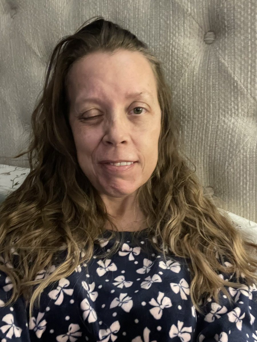 Carrie298924321's tweet photo. Our stories matter, and our voices have https://t.co/ST5aJsvq2r life changed forever after my injury,but I refuse to give up. Our class action lawsuit is moving toward certification in June 15-18.We deserve the truth!Your support keeps me going strong❣️ https://t.co/d7AyleMToI