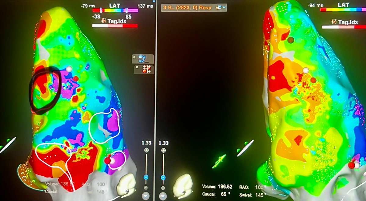 Ivo Roca, FEHRA, FESC tweet media