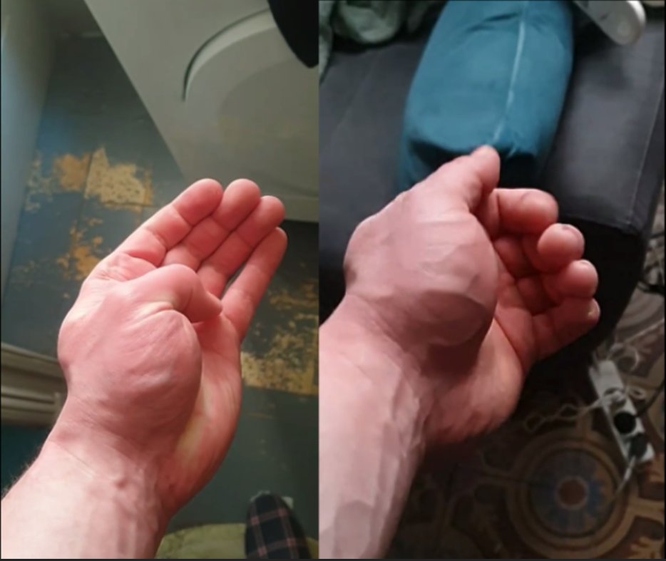 focusrelentless's tweet photo. 30 days transformation
( day 330 - day 360) 
One year comparison coming soon on youtube https://t.co/LOmfd4aNFq