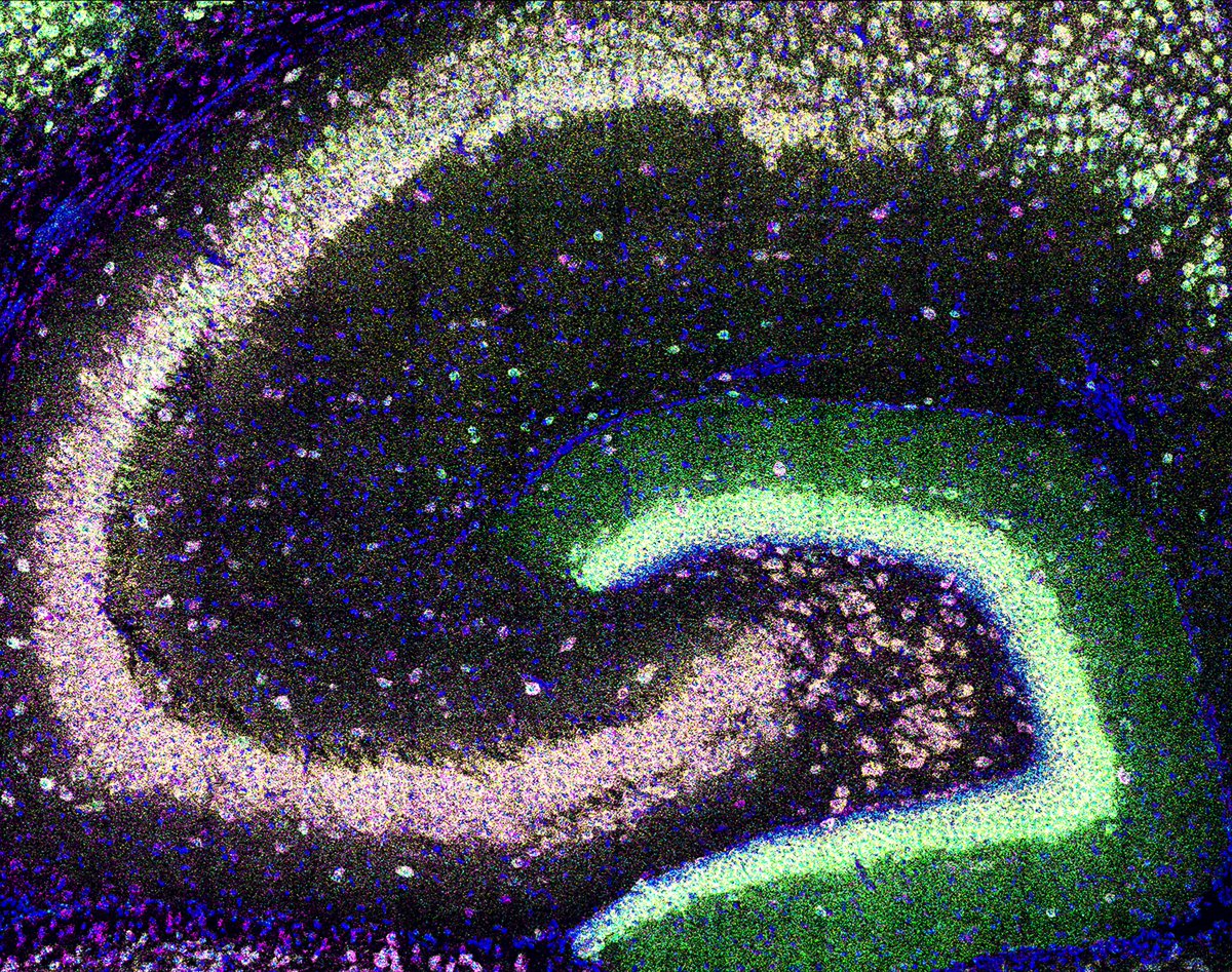SfNJournals's tweet photo. #SnapshotsinNeuroscience | Featured on the #eNeuro blog from Tarannum et al., expression of four neuropil-localized mRNA in hippocampal subregions of a young mouse. Photo Credit: Shannon Farris
https://t.co/uUcDeh1w86 https://t.co/vDqT7k4wLY