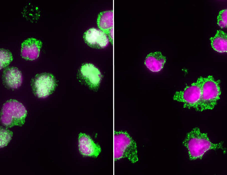 scisignal's tweet photo. Researchers investigate how substrate stiffness affects short- and long-term T cell responses to target cells and show that “softened” and pliable cancer cells impair #TcellActivation by reducing calcium flux dependent on stiffness. @Saar_Uni https://t.co/ECTySLYsqI https://t.co/99SgU3gvQ1