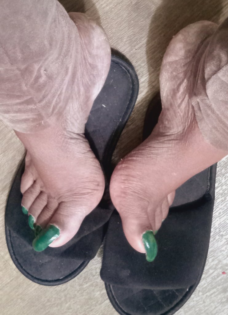 AsmrPrettyfeet's tweet photo. Powerful Nails n Ashy Heels
#longtoenails
#ashyheels
#prettynails
#prettytoes
#dryheels
#dryfoot
#dryfootheels https://t.co/Crms3wlpqQ
