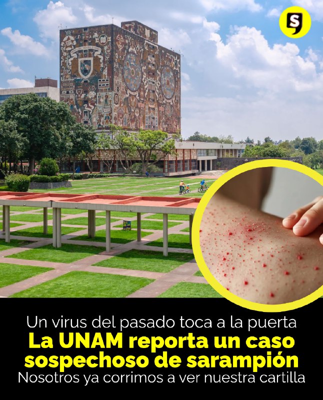 SubrayadoM's tweet image. 😷🩺 ¿Un caso de sarampión en la #UNAM? 

Sí, así es. La Facultad de Medicina reportó un caso sospechoso en un estudiante, posiblemente contagiado en una práctica de campo. 

#SubrayadoMx #SoloLoImportante