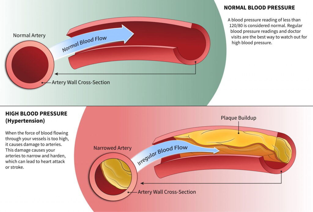 santi_despierta's tweet photo. Nutrientes clave que los hombres con erecciones débiles deberían tomar.

Basado en investigaciones científicas, estos nutrientes son clave para la salud sexual.

(La mayoría lo aprende demasiado tarde).

Hilo: https://t.co/oVT0cEwnxI