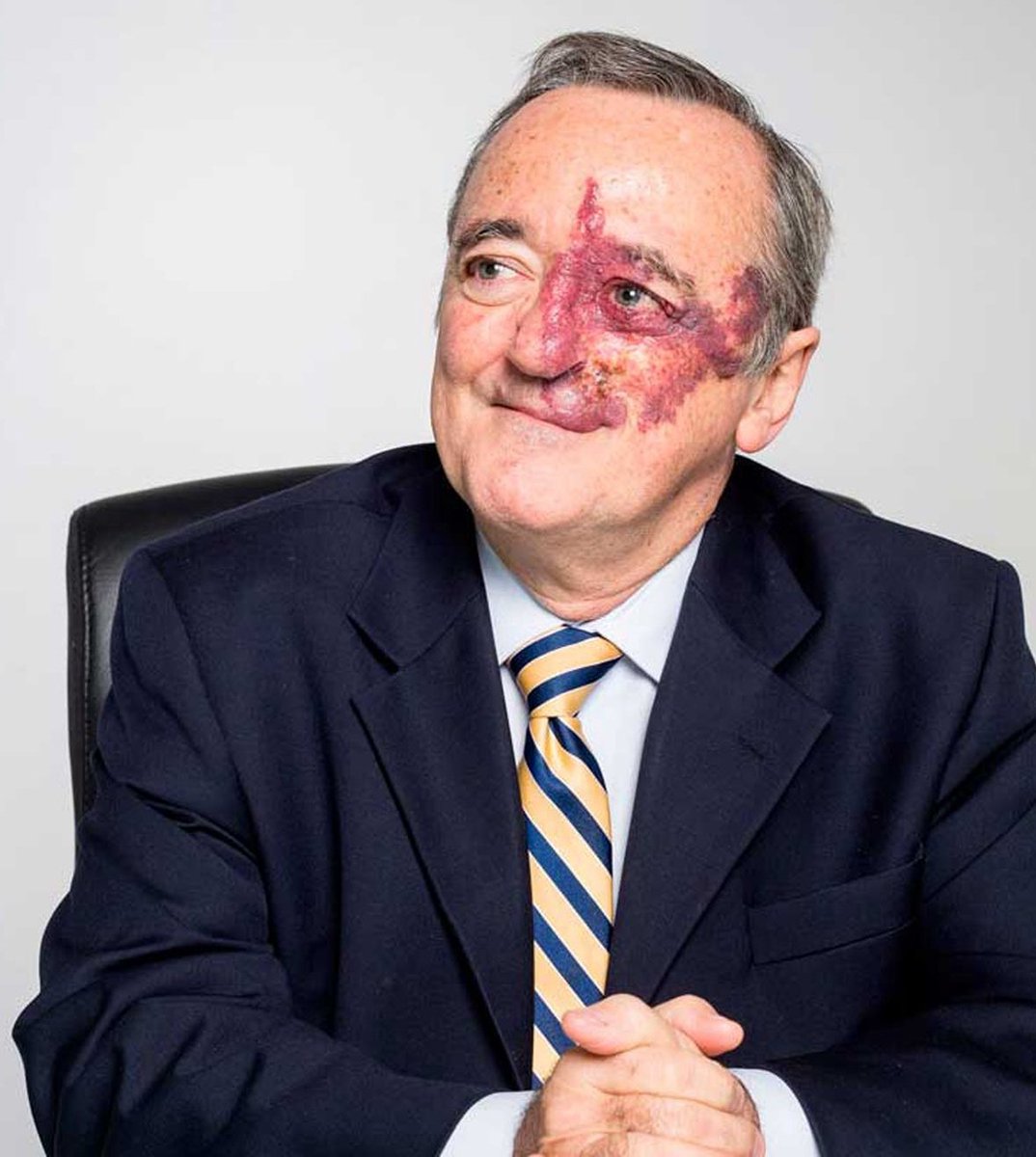 Imagina o tanto de bullying que ele sofreu, mas não desistiu e agora pode ter descoberto a cura do câncer de pâncreas.