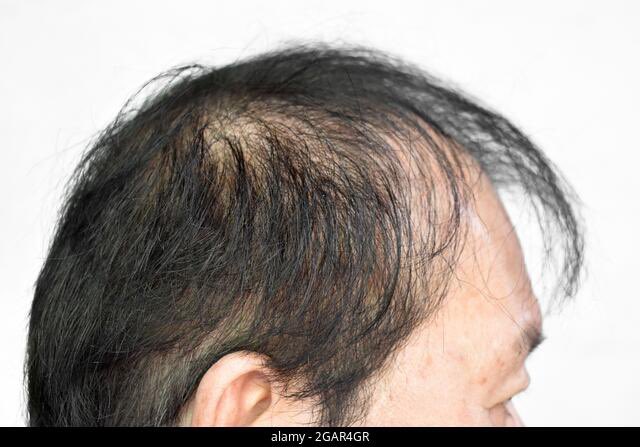 twinkdefcon's tweet image. my hair for the entire day versus my hair the second I get home for no reason