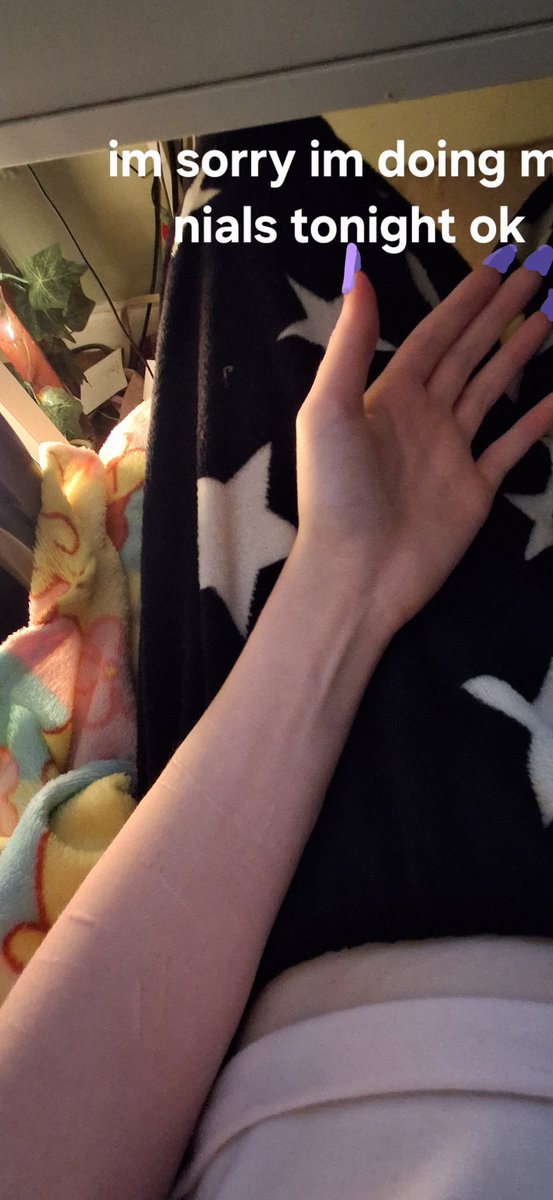 mleeber_'s tweet photo. why does my arm look so malnourished https://t.co/9Nex3t8dp6