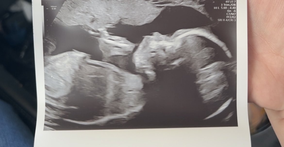 MacAttaccs's tweet photo. My baby boy 🥰💙 daddy momma and sissy can’t wait to meet you! https://t.co/rpMndmnntT