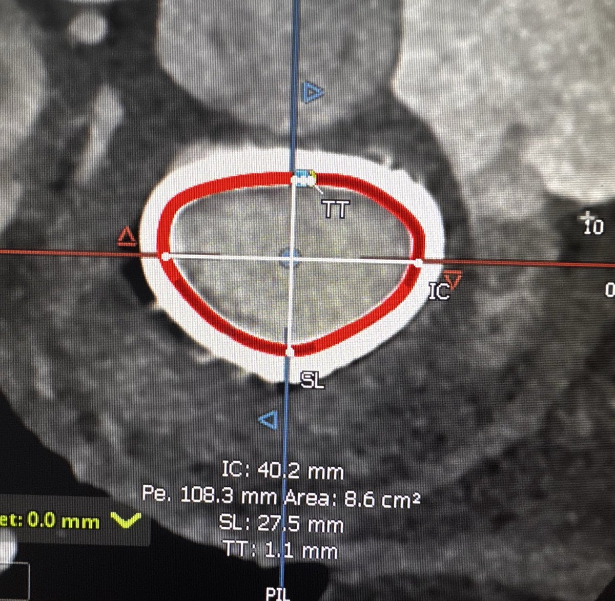 Paul Sorajja tweet media