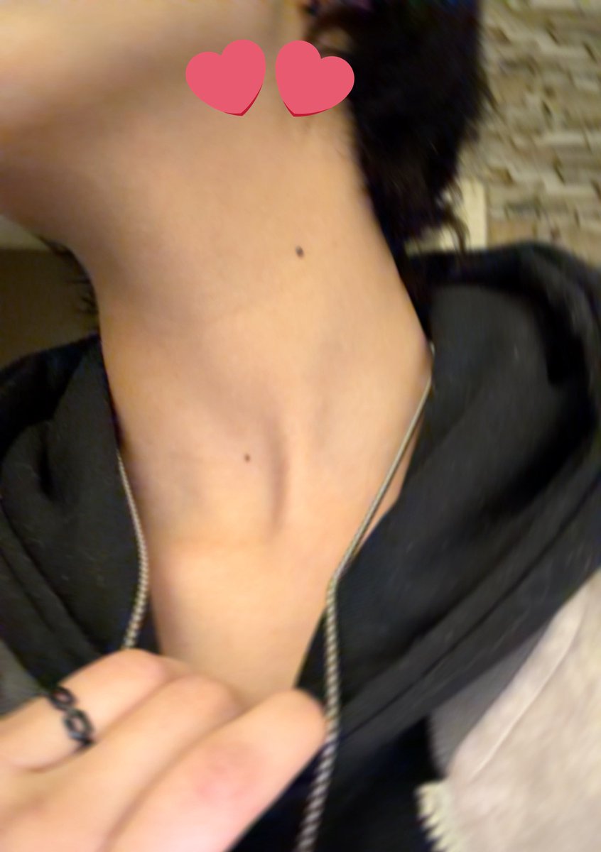 شامات رقبتي شيء ملفت باقي آمنيه تلقي neck kiss