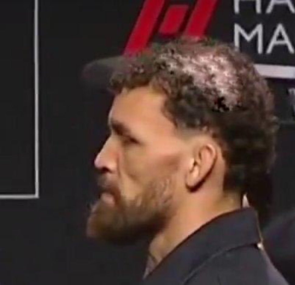 DovySimuMMA's tweet image. What’s up with Mauricio Ruffy’s hair???