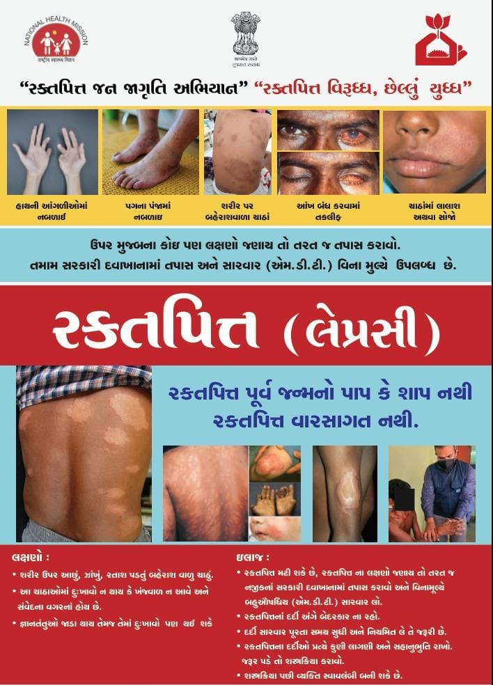 CdhoSabarkantha's tweet image. 🗓️ તા. ૩૦/૦૧/૨૦૨૬ થી ૧૩/૦૨/૨૦૨૬ (દિન–૧૫) 
“સ્પર્શ #લેપ્રસી અવેરનેસ કેમ્પેઇન”

સાબરકાંઠા જીલ્લામાં રાષ્ટ્રીય રક્તપિત (લેપ્રસી) નિર્મુલન કાર્યક્રમ અંતર્ગત વિશેષ જન-જાગૃતિ અભિયાન
“ભેદભાવ સમાપ્ત કરી, માનવ ગૌરવ સુનિશ્ચિત કરીએ”
#SLAC2026 #LeprosyAwareness #SparshCampaign #HealthForAll