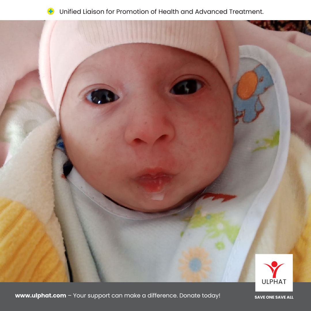 OrgUlphat's tweet photo. Sherbano’s Heart Surgery a Success!

Thanks to your support, baby Sherbano’s congenital heart condition has been treated. Her journey to a healthy life begins now.

#ulphat #welfare #SherbanosJourney #HeartSurgerySuccess #Hope #Gratitude #LittleWarrior #NewBeginnings https://t.co/DNtKfjeEHm