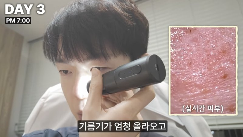 Eksperimen Dermatologis, Hanya Makan Tepung, Snack, dan Hamburger Selama Seminggu

Dermatologis Lee Seungju lewat channel Youtube-nya melakukan eksperimen untuk membuktikan bahwa pola makan mempengaruhi kesehatan kulit. Selama seminggu, ia mengonsumsi berbagai makanan berbahan