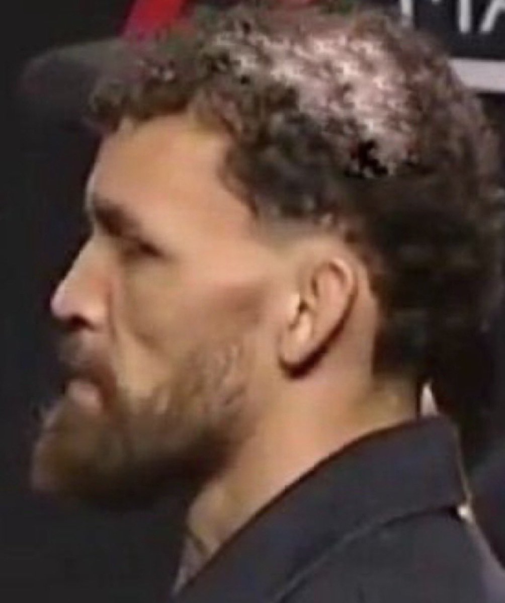 ChickenKingMMA's tweet image. Mauricio Ruffy &amp;amp; Conor McGregor have the same side profile