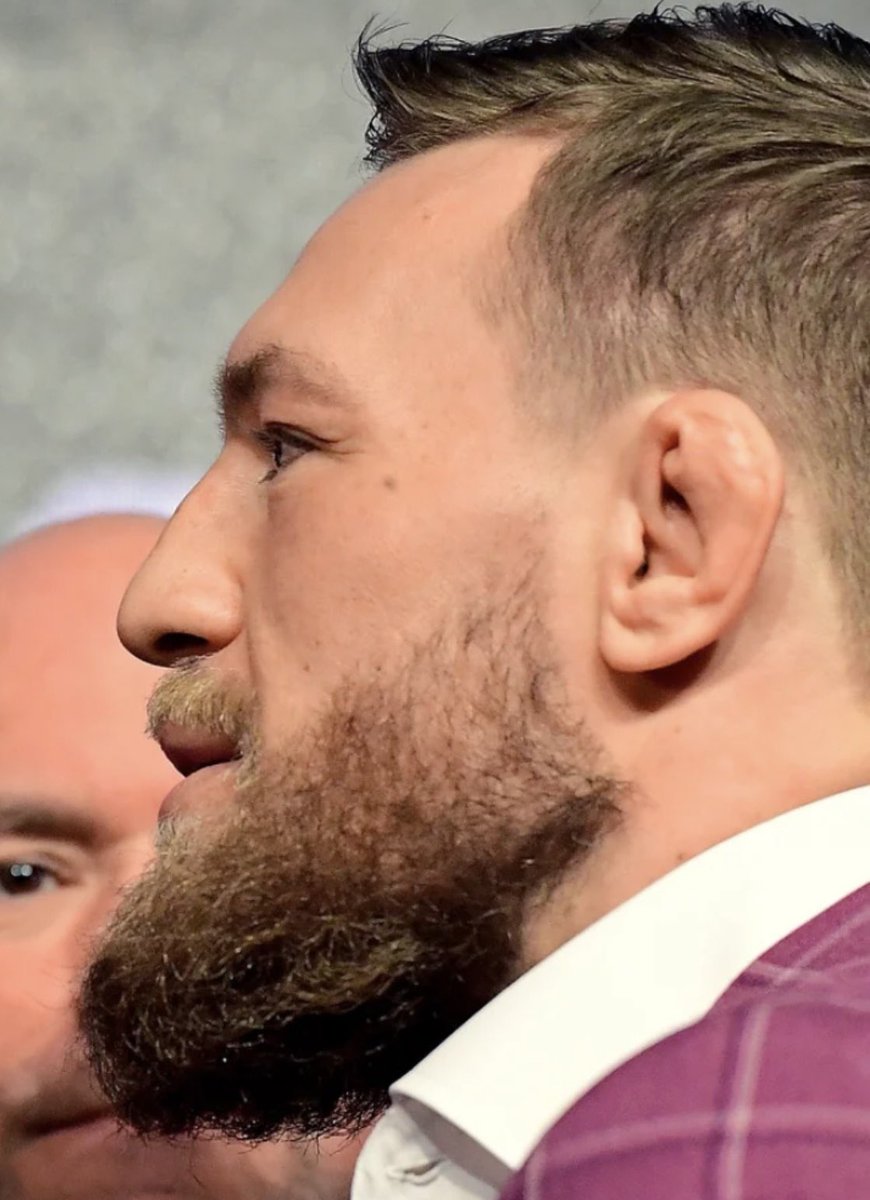 ChickenKingMMA's tweet image. Mauricio Ruffy &amp;amp; Conor McGregor have the same side profile