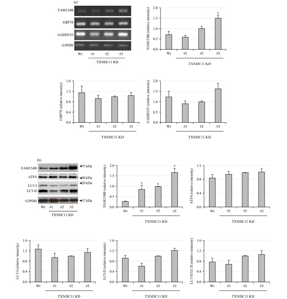 IJP_IMRPress's tweet photo. 🧪The work from @GifuUniv_PR by Prof. Kentaro Oh-hashi and his team is featured in IJP!
Article 👉: https://t.co/fK6AAwG3oc
💡How does #TXNDC11 shape #ERStress responses by balancing #ERAD and #ERphagy in neuronal cells?
#cellbiology #neurobiology https://t.co/SZqL6za648