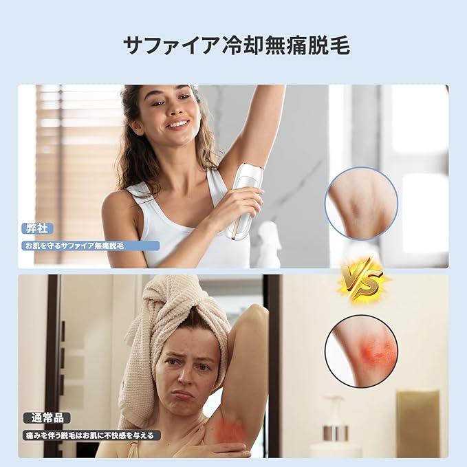 Yundoo_JP's tweet photo. 💡痛みのあるムダ毛ケアはもう卒業！

従来のケア →
カミソリ負け・赤みが気になる😣

#YUNDOO 脱毛器 → 刺激を抑えて、やさしく・安心ケア✨

今日から、
もっと気軽なセルフケアを始めませんか？📝

#脱毛 #ムダ毛処理 #家庭用脱毛器 #美肌ケア #スベスベ肌 #痛くない脱毛 #セルフケア https://t.co/S5MFl3YmOP