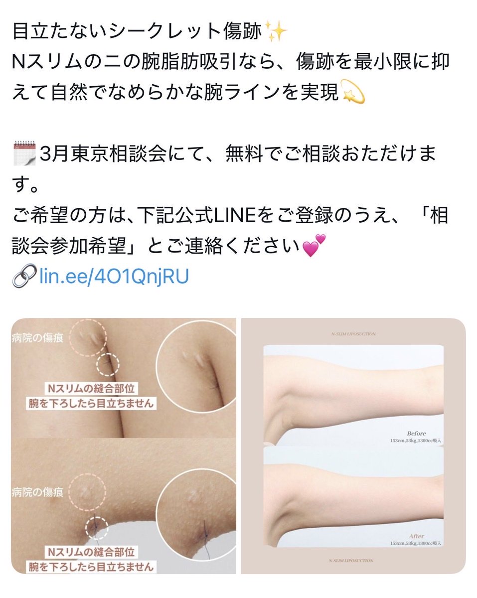 zho10's tweet photo. 左腕ぜんぜん見える位置に傷跡のこってるよ🙊ははは https://t.co/ftP5kpHbnR